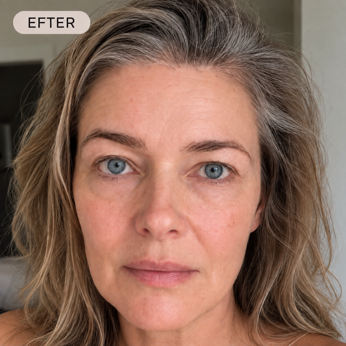 before-after-after